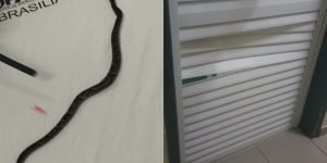 crianca-picada-cobra-jararaca