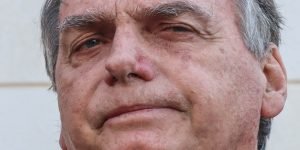 jair-bolsonaro-cirurgia-no-ombro