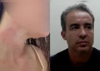 mulher-denunciou-jadson-por-agressao-01125400-0-20006657760202608101536.webp.webp